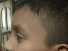 अध्यापिका ने छात्र को किया लहू लूहान