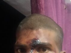 काशीपुर गांव में दलितों के घर पर हमला, घर में घुसकर तोड़फोड़-आगजनी का आरोप